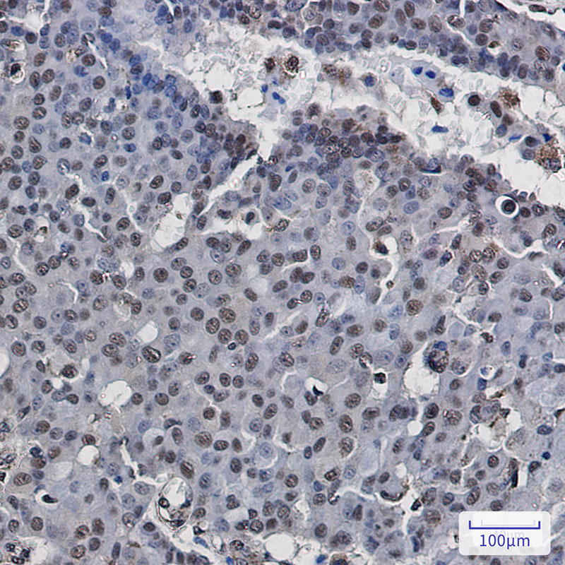 RNA Polymerases I/II/III Subunit ABC1 Rabbit mAb